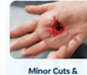 Minor Cuts